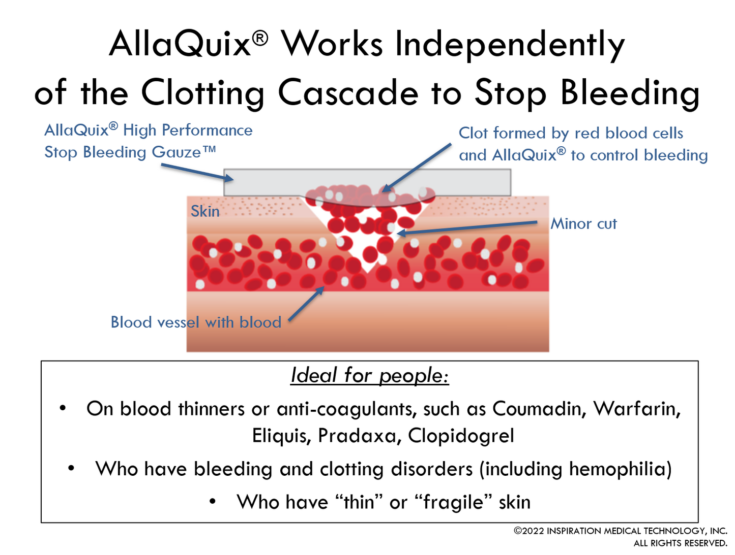 HTC - AllaQuix Stop Bleeding Gauze (LARGE 2" x 2") - Box of 10